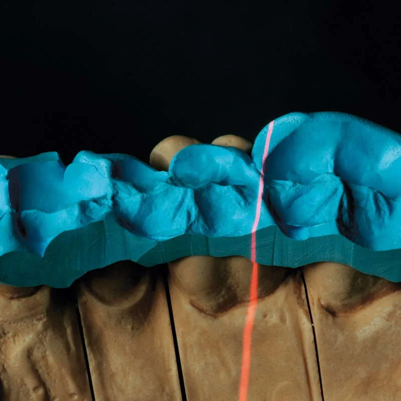 Occlufast_CAD_app1 Por cortesía de Zhermack SpA