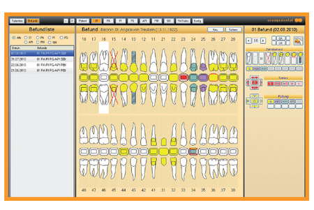 Sonda periodontal Pa-on medición