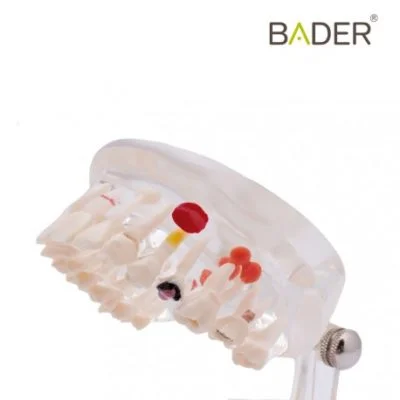 Modelo acrílico transparente caries bader