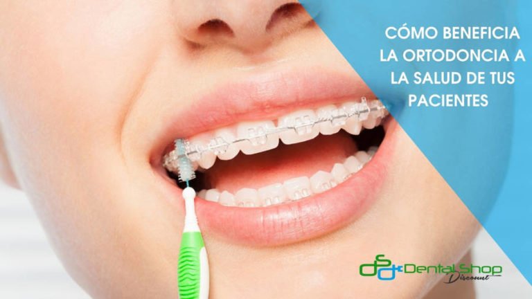 Beneficio de la ortodoncia