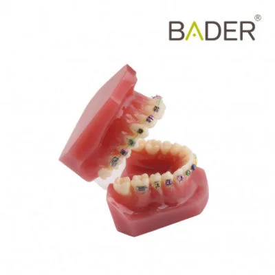 Tipodonto con brackets metálicos y de zafiro.