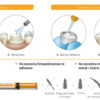 Cemento universal de resina adhesiva Kit introducción