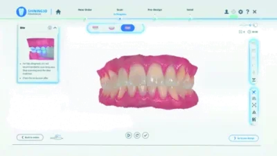 Escáner Intraoral Aoralscan 3