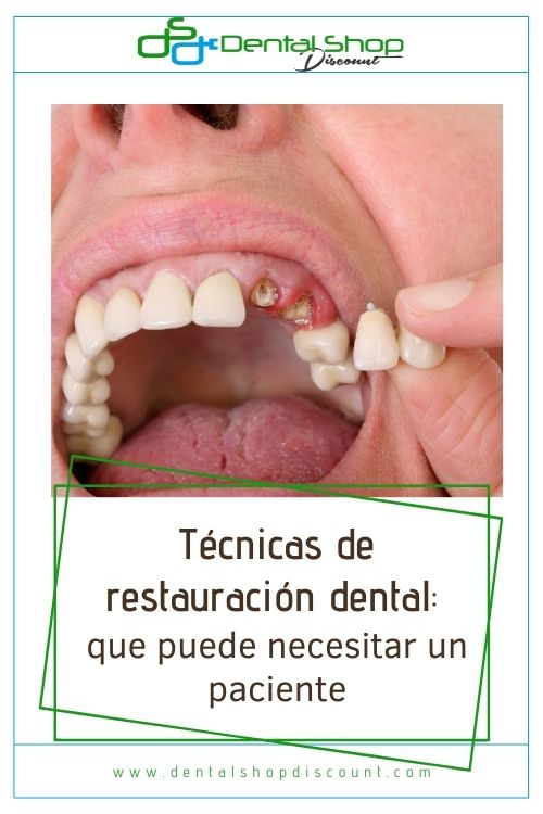 técnicas de restauración dental