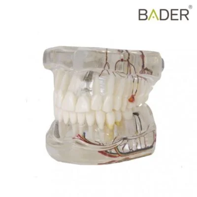 Modelo dental de implante con nervio
