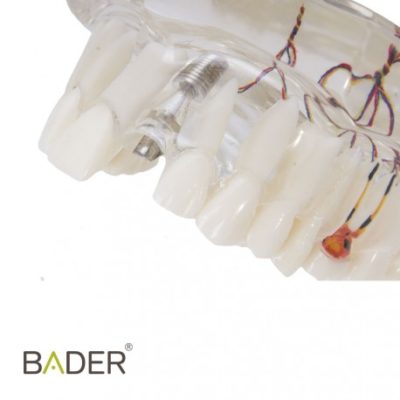 Modelo dental de implante con nervio