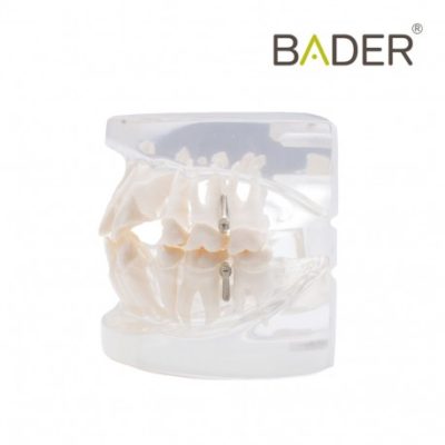 modelo-dental-para-practica-de-ortodoncia-bader