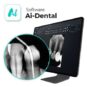 POTENTE SOFTWARE AIDENTAL