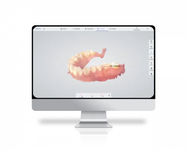 5-Oral-scanner-3D-BADER-600x480