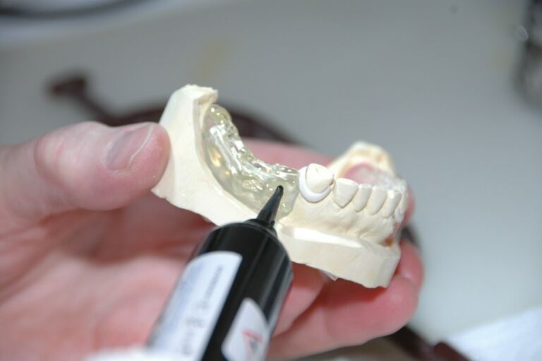 Adhesivos Dentales