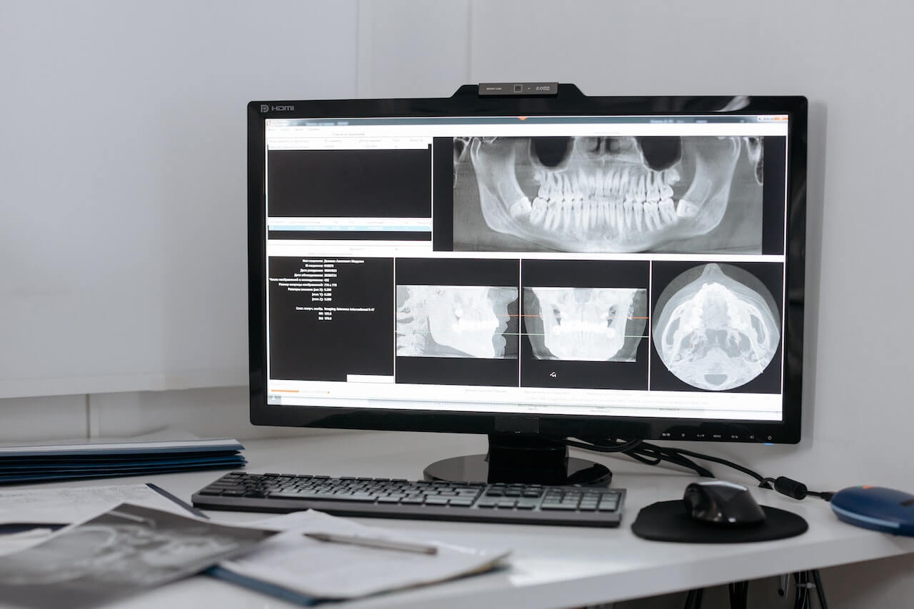 Radiografia panoramica y TAC dental