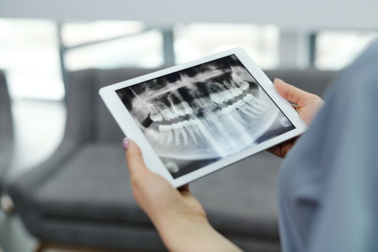 Radiografias periapicales