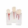Set de Dientes Endo para Práctica