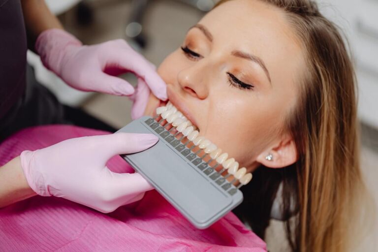 Composites dentales
