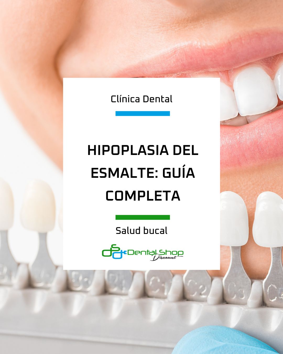 Los tratamientos dentales para hipoplasia dental pueden ayudar a mejorar la apariencia de la dentadura aportando seguridad y salud bucodental.