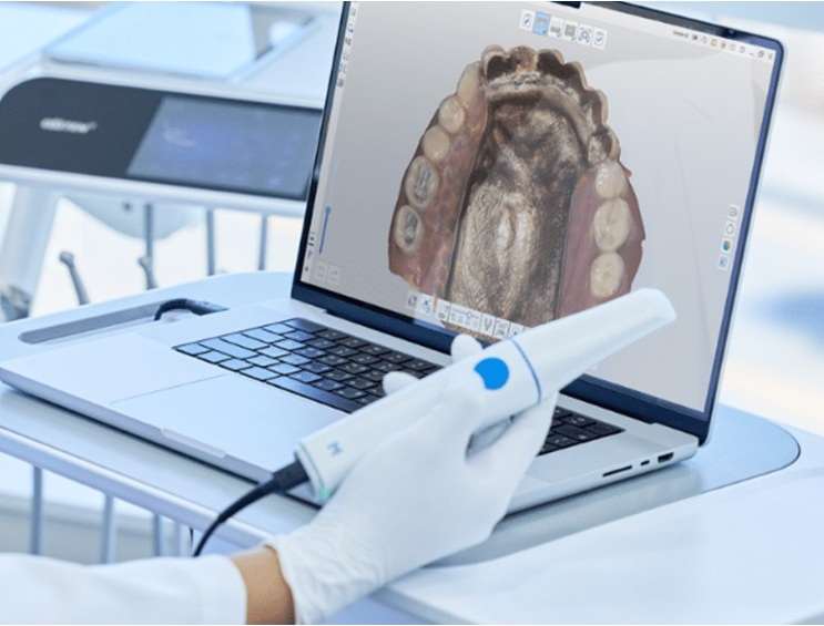 Escáner dental intraoral Medit i900 Classic