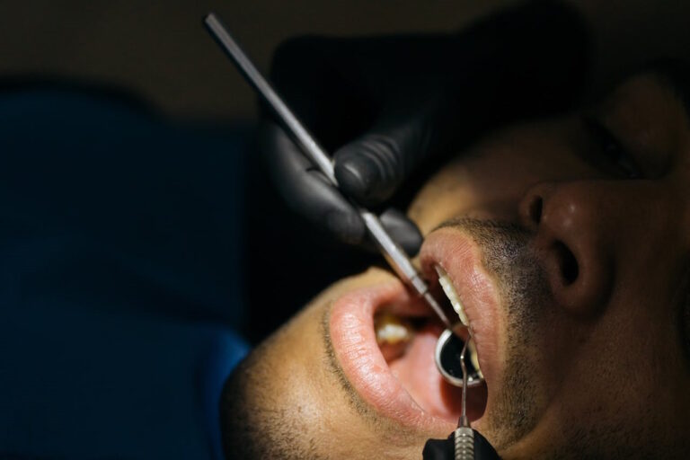 Uso de amalgama en clínicas dentales