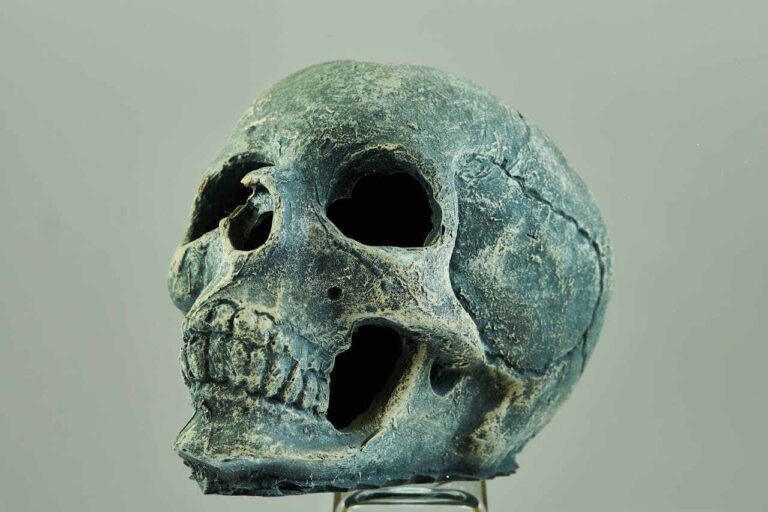 odontología forense