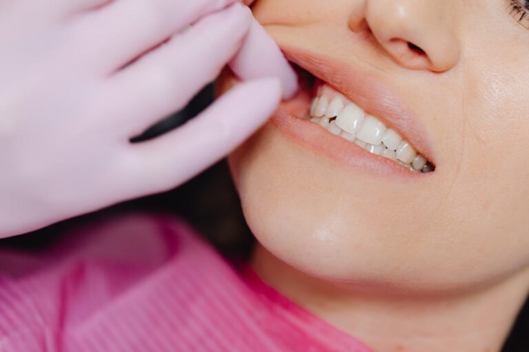 Beneficios del desensibilizante dental