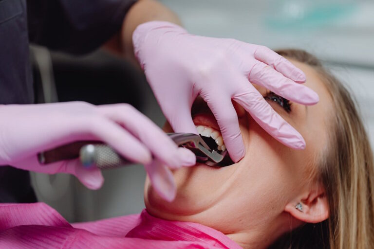 Extraccion dental atraumatica