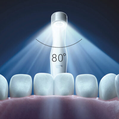 CAMARA-INTRAORAL-CON-ORDENADOR-DM-CAM-PRO-28-DMCAMPRO-3 CAMARA-INTRAORAL-DM-CAM-28-DMCAM