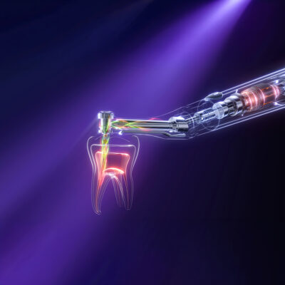 MOTOR-ENDO-GT-PR-28-ENDOGTPRO-4 Motor de endodoncia WOODPECKER| ENDO GT PRO