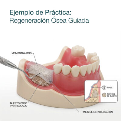 Regeneracion-osea-guiada (1) Fantoma Kim para Práctica de Regeneración Ósea