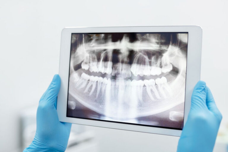 Seguridad Radiológica Dental