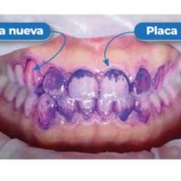 INDICADOR BITONAL Revelador de Biofilm