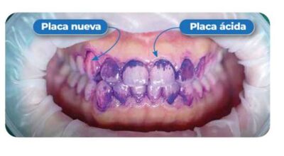 INDICADOR BITONAL Revelador de Biofilm INDICADOR BITONAL Revelador de Biofilm