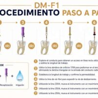 procedimiento paso a paso DM-F1