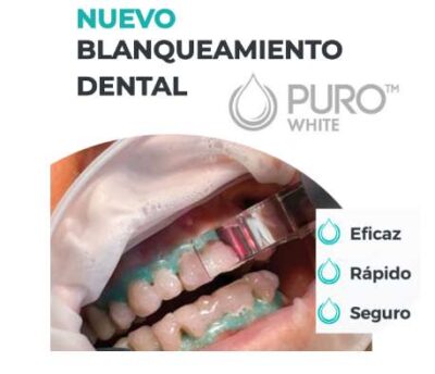 PURO WHITE de Medency Kit Blanqueamiento Dental PURO WHITE Medency 35% para Láser de Diodo