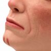 Modelo-facial-para-practicas-de-inyeccion-estetica