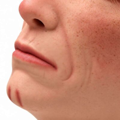 Modelo-facial-para-practicas-de-inyeccion-estetica